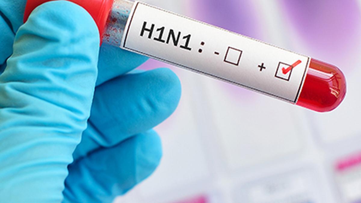 H1N1 cases spike across the country